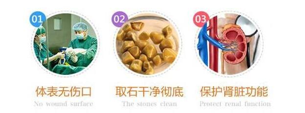 肾结石手术要多少钱？(已解决6955条)(图2)