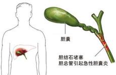 呕吐和发热