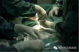 胆结石怎么治疗？(图1)