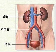 肾结石不治疗会怎样(图1)