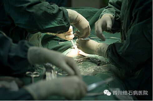成都治疗胆结石哪家医院好？(图4)