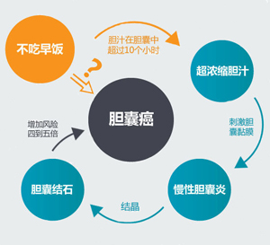 正确认识胆囊结石危害  及时治疗(图2)
