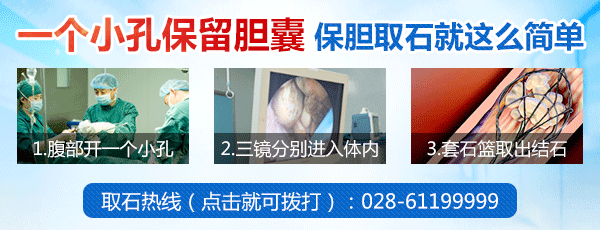 胆结石疼痛怎么办？怎样缓解疼痛？(图4)